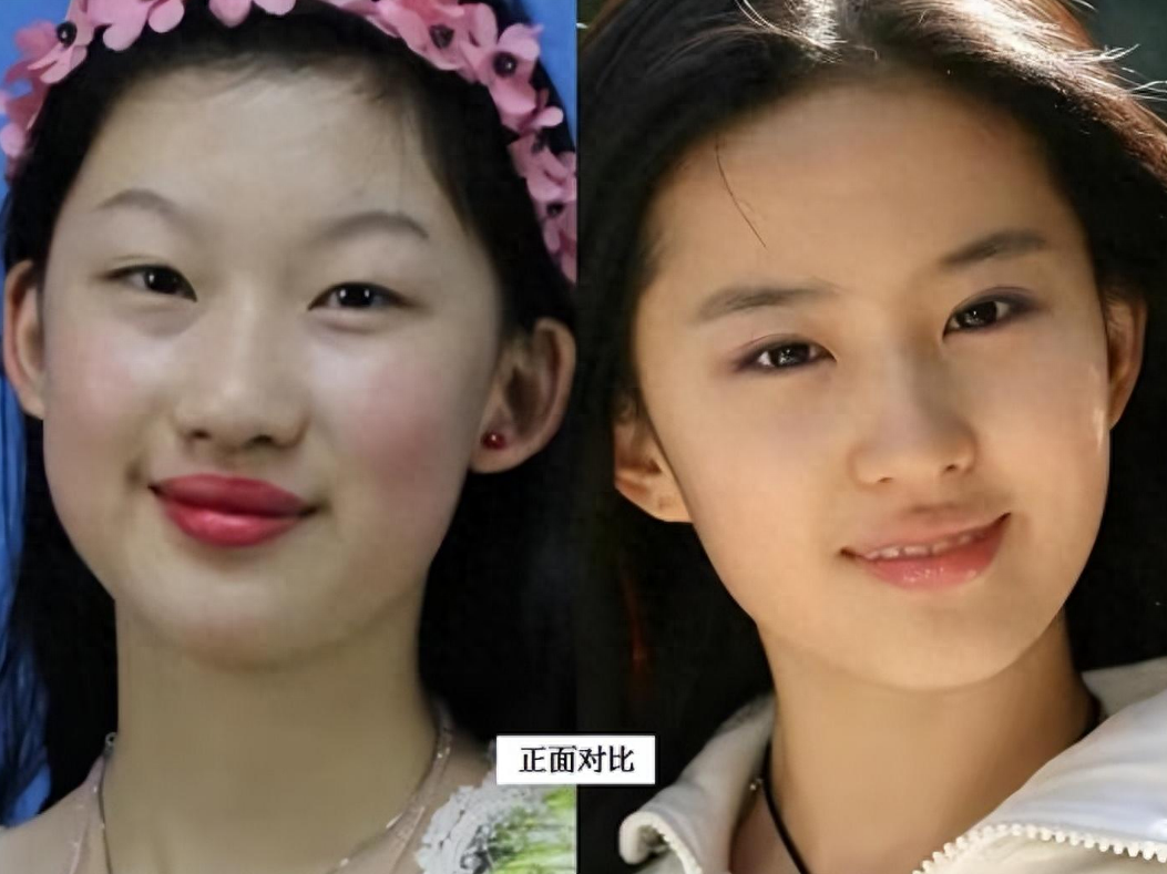 7年前那个花100万整容成刘亦菲的女孩，如今颜值却变成了这样？