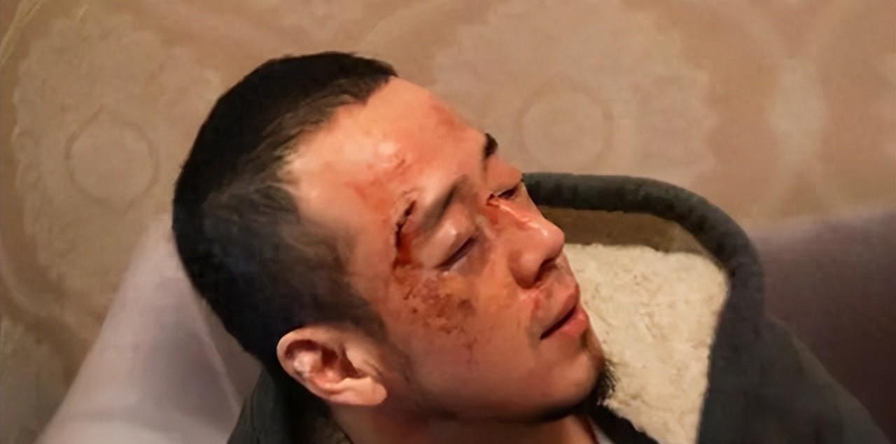 51岁杨坤在长沙演出后被打，鼻青脸肿？警方回应了